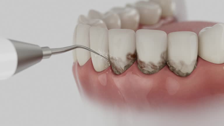 Trusted Tooth Extraction service in Krugerville, TX - Dentist Open Now